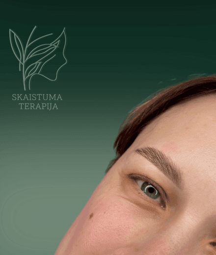 Skaistuma Terapija