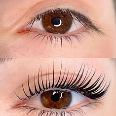 Skropstas un uzacis, Rīga