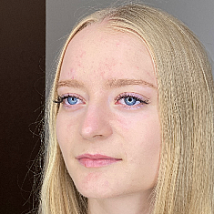 Skropstas un uzacis, Rīga