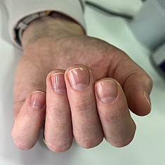 Маникюр, Tukums