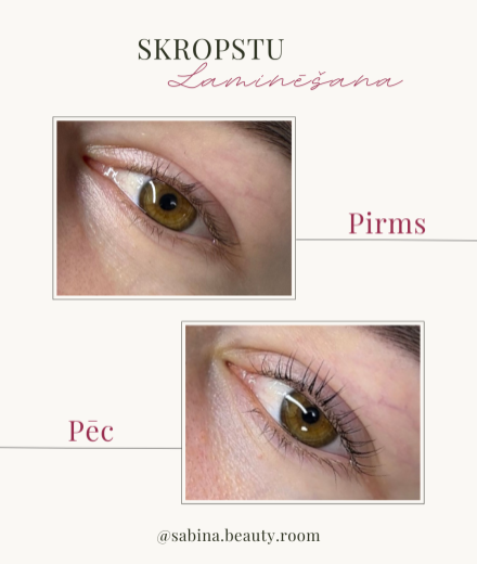 Skropstas un uzacis, Rīga Torņakalns